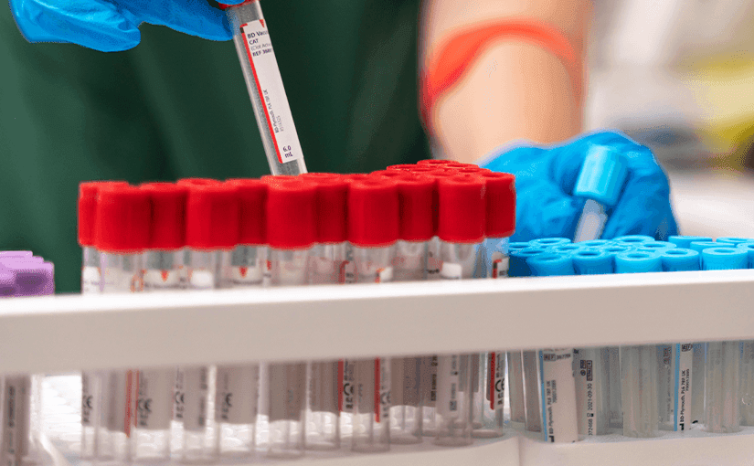 Lipidograma: O que é, preparo, interpretação